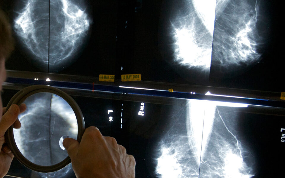 Breast cancer screening program extended